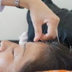 The calming effect of acupuncture