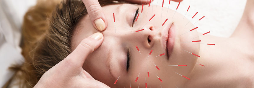 Kozmetická akupunktúra tváre (Akupunktúrny facelift)